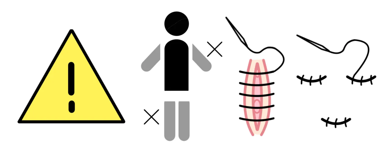 Sutured Puppet page 2 full
